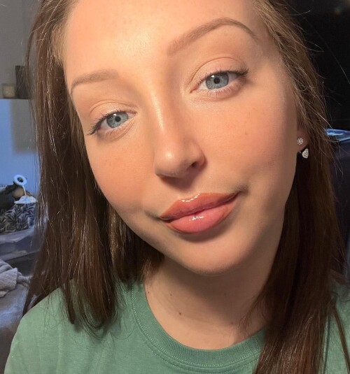 4a710bf298796218efd6338e3417a07d