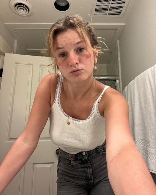 914ae56072473b66d491d88cbca67e5b